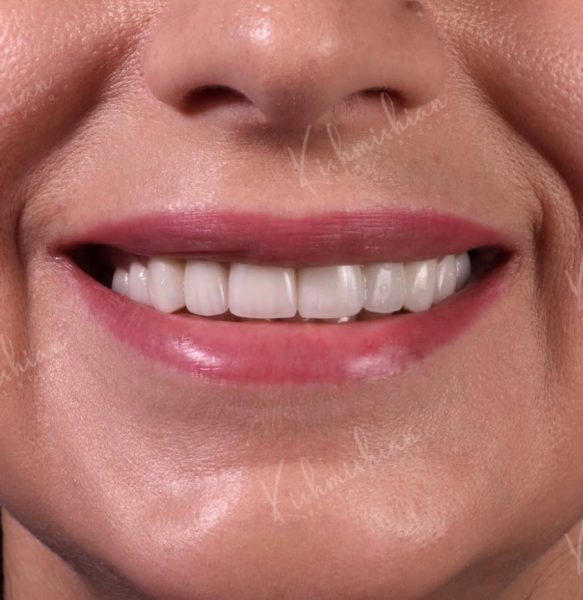 Kishmishian Dental Studio