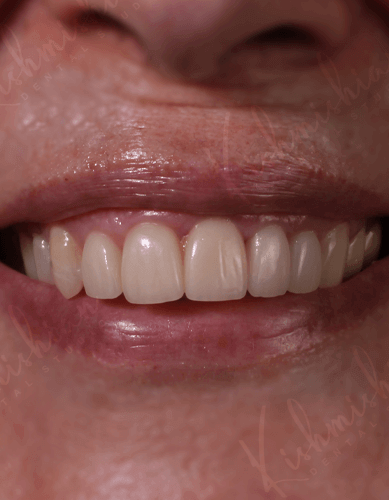 Khishmishian Dental Studio